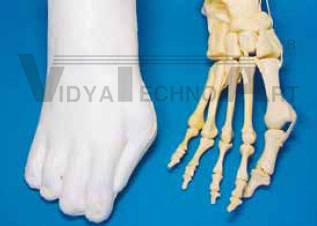 Hallux foot, single bones, foam coat